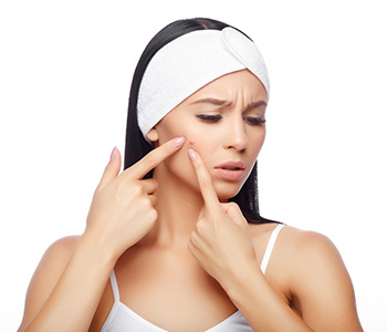 Treatment for acne